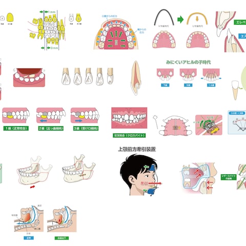 患者説明用イラスト