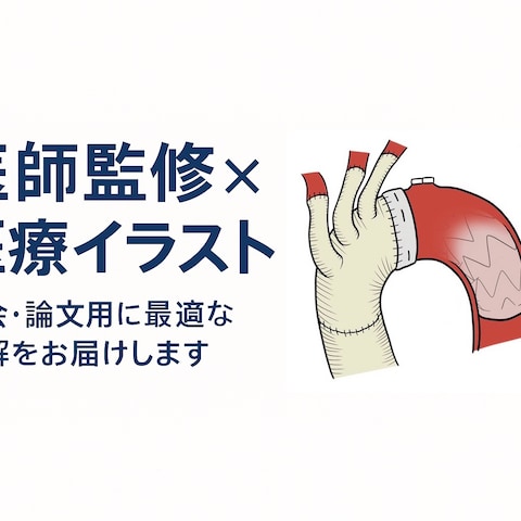 医師監修による医療イラスト制作
