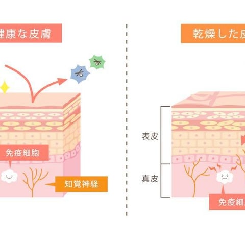 医療用イラスト制作