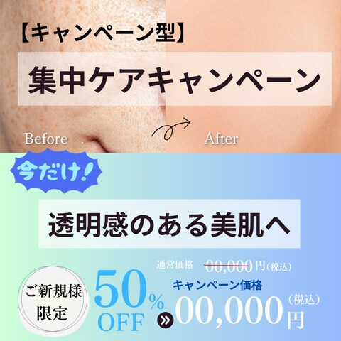 期間限定型　キャンペーン