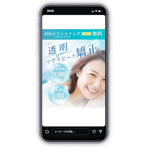 審美歯科のSNS広告バナー(架空)
