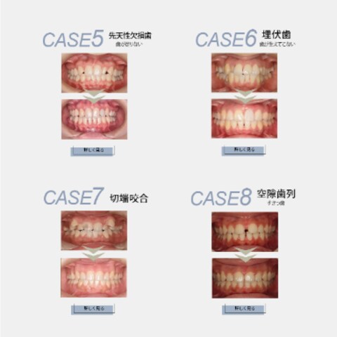 矯正専門歯科クリニックLPデザイン