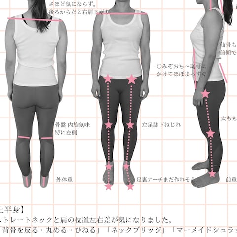 骨格分析の例
