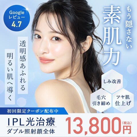 IPL光治療の広告バナー
