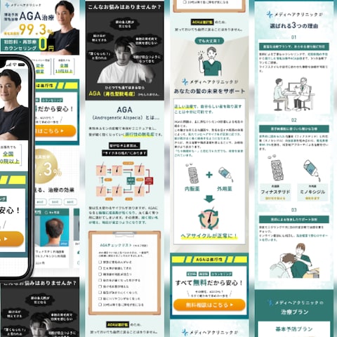 薄毛・AGA治療のランディングページ