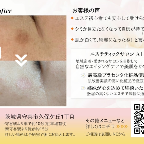 エステサロンチラシ　裏