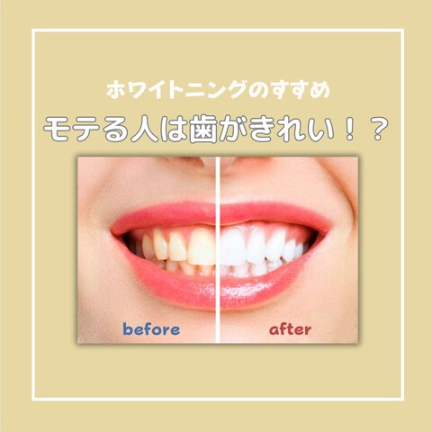 歯科系Instagramアカウント投稿デザイン
