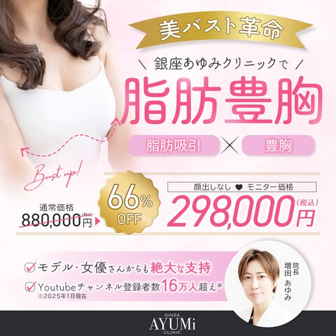 広告バナー