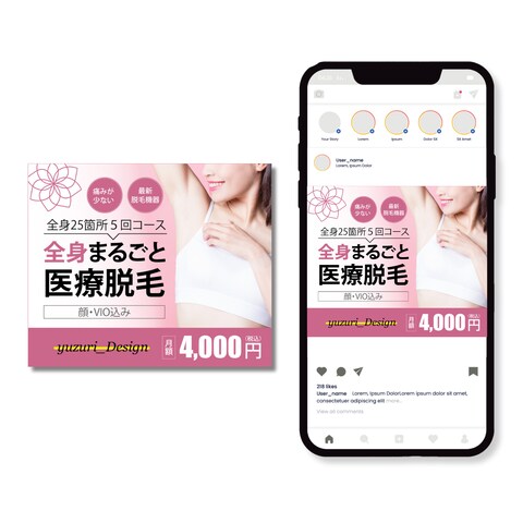 脱毛サロン申し込みバナー