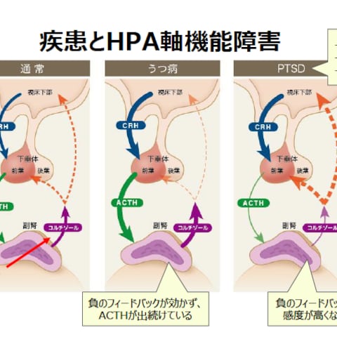 視床下部-下垂体-副腎系　HPA軸
