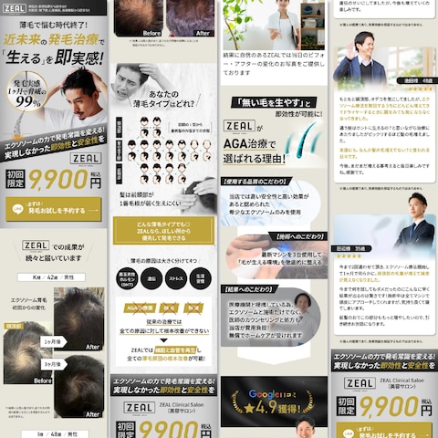 発毛治療サービス