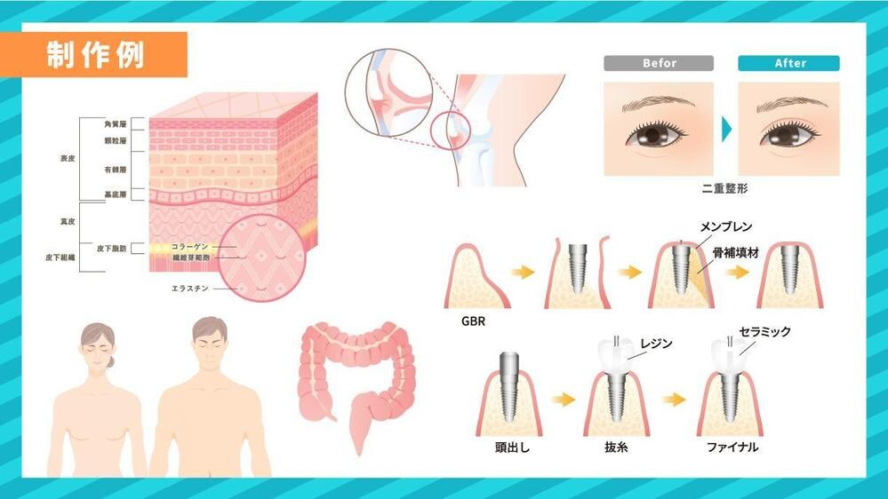 医療用イラスト制作