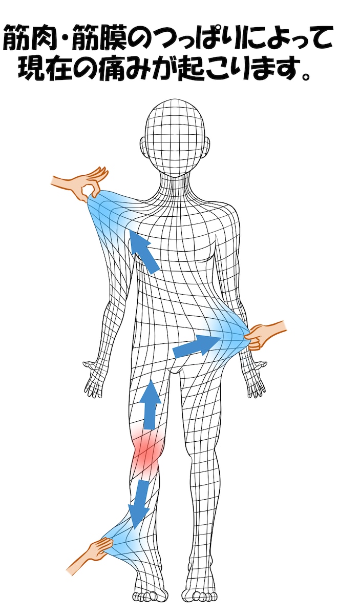筋膜の説明図
