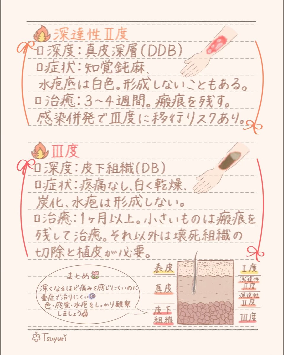 熱傷の分類②