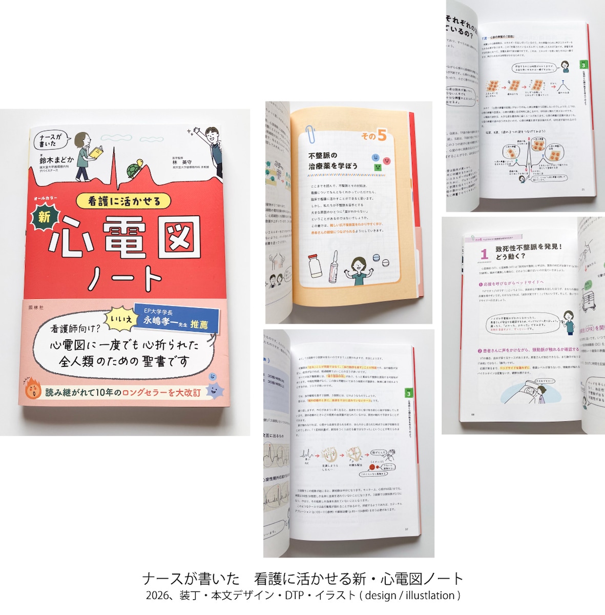 ナースが書いた　看護に活かせる新・心電図ノート