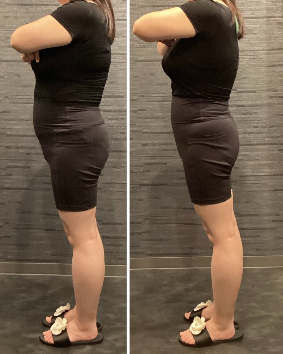 美容骨盤矯正　ダイエット