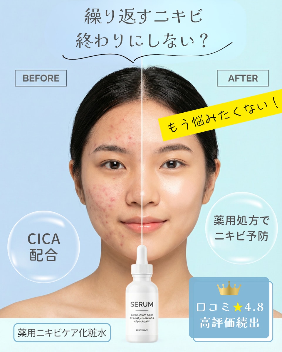 薬用ニキビケア化粧水｜ビフォーアフターバナーデザイン