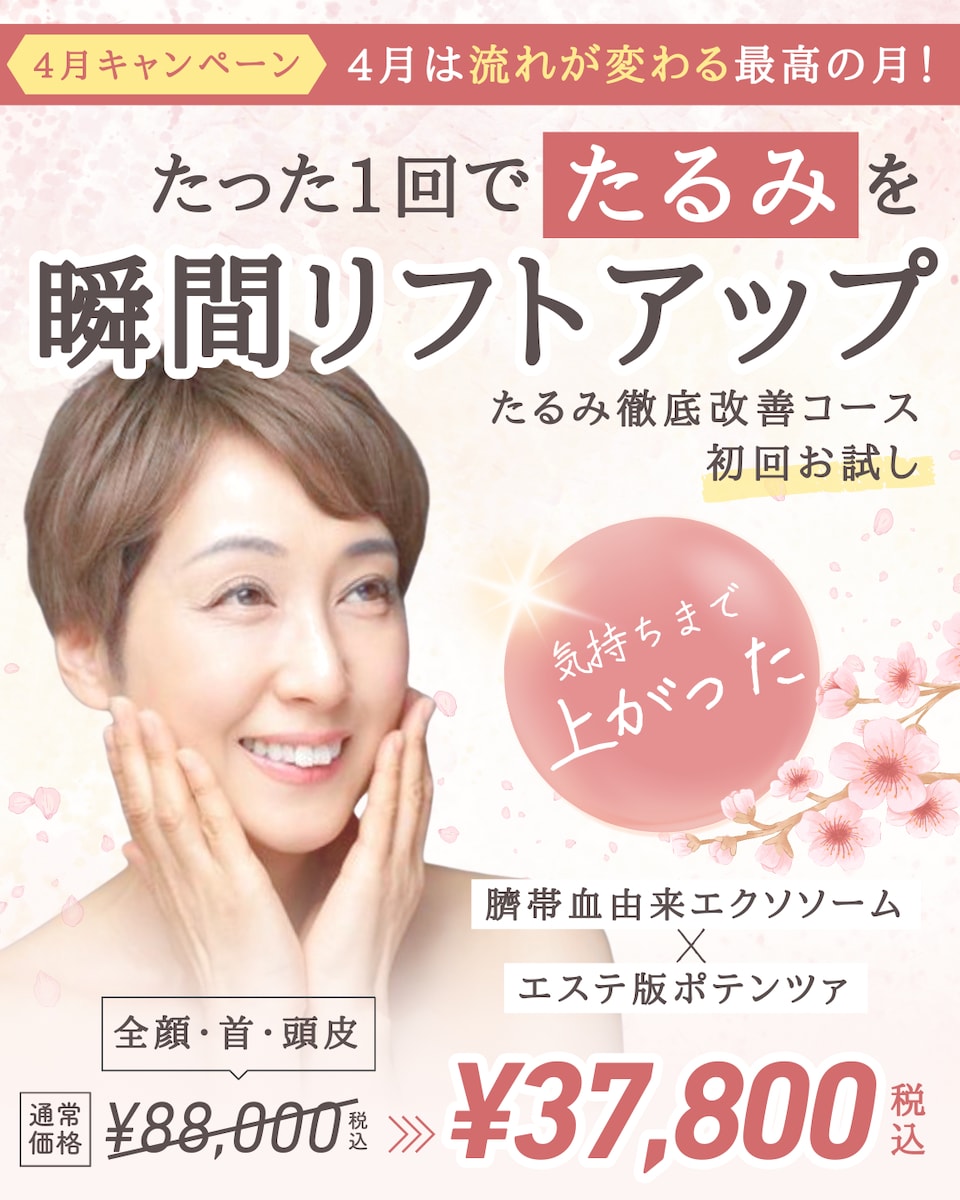 キャンペーンバナー