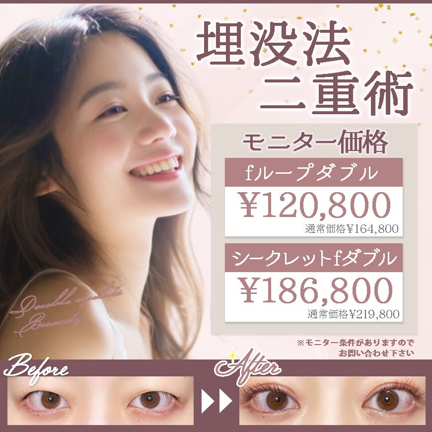 美容医療バナーデザイン