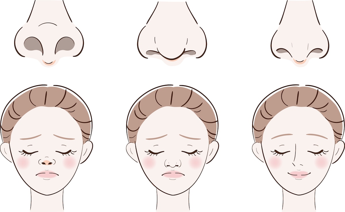 美容外科の鼻整形で使用する「色々な鼻の形のイラスト」